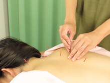 ナディ鍼灸治療院/鍼灸