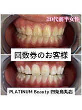 プラチナムビューティ 四条烏丸店(PLATINUM Beauty)/回数券ご利用のお客様