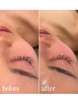 リム(Lim:)/リアボーテ◆マーメイド