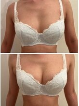 エスビューティー 三軒茶屋(S beauty)/バストケア・池尻大橋・痩身