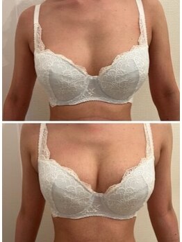 エスビューティー 三軒茶屋(S beauty)/バストケア・池尻大橋・痩身