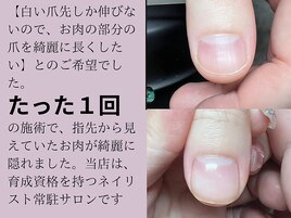パラジェル深爪緩和クリアコース