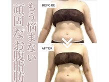 ソワン(Soin)/50代　お腹