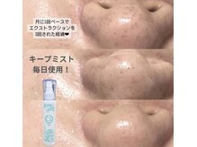 ミラーヴ(MERAVE)/毛穴ミストで黒ずみ消えた！