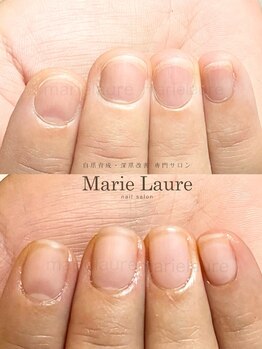マリーロール 天王寺店(Marie Laure)/深爪矯正/自爪育成/ネイルケア