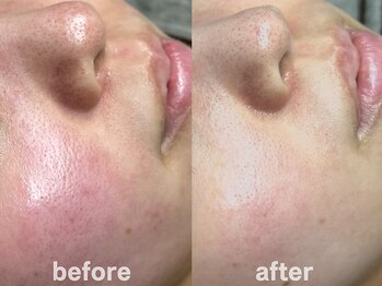 ホワイトアクア 鹿児島店(WHITE AQUA)/ララピール/鹿児島ララピール