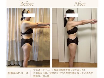 ヨサパーク オヨウ 荏原中延(YOSA PARK Oyou)の写真/完全個室【新体感！温活デトックス+リンパケア】で代謝UP!体脂肪を燃焼&本気痩せを徹底サポート