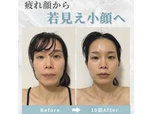 ビコツプロ(Bikotsu Pro)