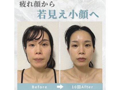 ビコツプロ(Bikotsu Pro)の写真