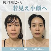 ビコツプロ(Bikotsu Pro)