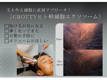 ワイビューティ(Y.Beauty)の雰囲気（近赤外線で頭皮の血行を促進。毛根に栄養を届けて、抜け毛を防ぐ）