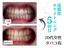 ルカノン(le canon)/ワンランク上の白さになりました