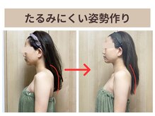 ビィミング(beaming)の雰囲気（姿勢が良くなることで、たるみにくいお顔に）