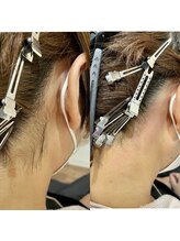 デザインファム(DESIGN FAM)/うなじワックス脱毛