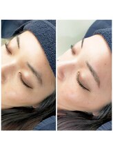 グラマラス 白金台店(glamourous produced by Noble)/美眉スタイリング[白金台/目黒]