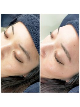 グラマラス 白金台店(glamourous produced by Noble)/美眉スタイリング[白金台/目黒]