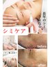 【シミケア10箇所/大人気！】夏のシミ撲滅キャンペーン☆ ¥12500→¥6000