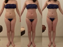 ラヴィエ ベル(La vie est belle)/セルライトゼロ2 全身