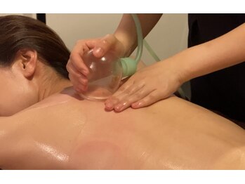 エステティックサロンティエリーの写真/だる重首肩こりに【筋膜リリース+スライドカッピング】デコルテマッサージ付で血流改善×痩せやすい身体へ