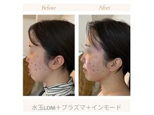 ＊関西初最新機器多数完備＊