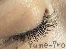 ユメイロ(Yume-iro)の雰囲気（IPLフラッシュ脱毛。痛みが少ないのに効果はバッチリ！）