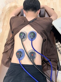 カラダサポート鍼灸接骨院 太田藤阿久店/筋コリ、張り、痛みの緩和