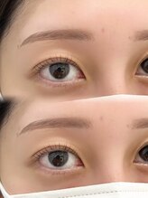 チル アンド アイ 船橋駅前店(Chill&Eye)/美眉スタイリング/BeforeAfter