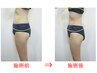 【ダイエット痩身】美容整体＋脂肪を減らすキャビ＆ラジオ波¥22000⇒¥13200