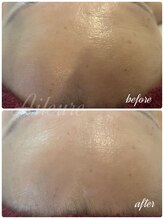 エルール トータルビューティ(Aileure total beauty)/ララピール