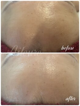 エルール トータルビューティ(Aileure total beauty)/ララピール