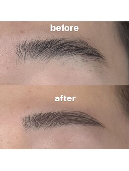 ナポーラ(NAPORA)/