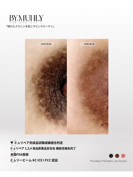 モア(more.)/黒ずみケア一回の変化