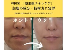 マールム(MALUM)/インセルダム