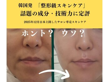 マールム(MALUM)/インセルダム