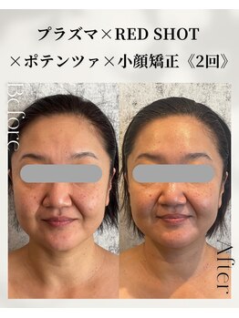 ネイルアンドアンチエイジングドゥシール(Docile)/50代女性｜小顔矯正・たるみ改善