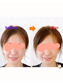 カオノツボ(kaonotubo)の写真/【キュッと立体的な小顔へ】内臓やホルモンバランスを整え、体の中から本来の力を引き出します。