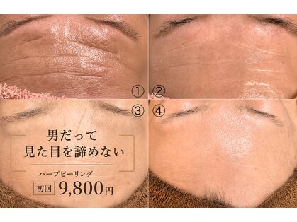 イーネ(ENE)の写真