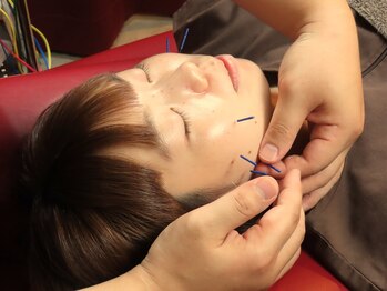 ミトラ鍼灸接骨院 参宮橋の写真/【他とは違う美容鍼】継続施術で肌質改善。血行促進でトーンアップ!年齢肌、くすみ、シワ、たるみの改善へ!