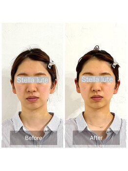 ステラルーテ(Stella lute)/80分コースでも小顔効果大です◎