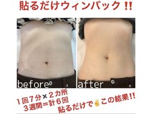 トレ ジョリ(Tre’s Jolie)の雰囲気（【 WINBACK 】代謝機能促進/リラクゼーション/肌質改善/浮腫み）