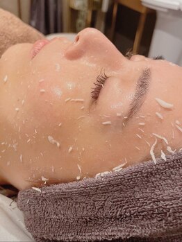 ハートフル ビューティー(HEARTFUL BEAUTY)の写真/艶肌を諦めてしまっている方必見◎《セルマンピーリング》で極上艶玉肌を叶えます!3か月で本気のお肌改善☆