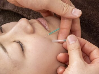 ユウキシキ(YUKISIKI)/YUKISIKI小顔矯正&美容鍼