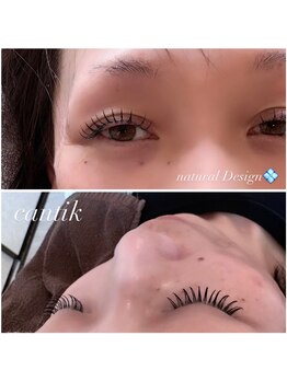 チャンティック (CANTIK)/キープ力に自信あります♪