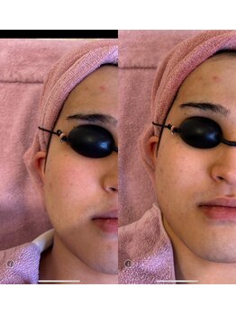 アムンドシャルム(Amun de Charme)/今月の一押しクーポン