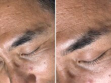 凛眉(LINVI)/自然に整う似合わせ眉