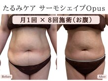 ラエッセ(La Esse)/お腹の脂肪＆ゆるみ諦めないで！