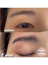 ラナ バイ アンドライフ ショウナン(Lana by andlife Shonan)/HBL ハリウッドブロウリフト