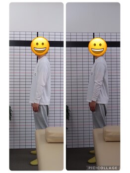 ことぶき整骨院/姿勢矯正