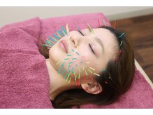 おおの鍼灸接骨院/美容鍼【姫路/小顔矯正/肩こり】