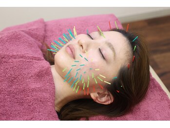 おおの鍼灸接骨院/美容鍼【姫路/小顔矯正/肩こり】